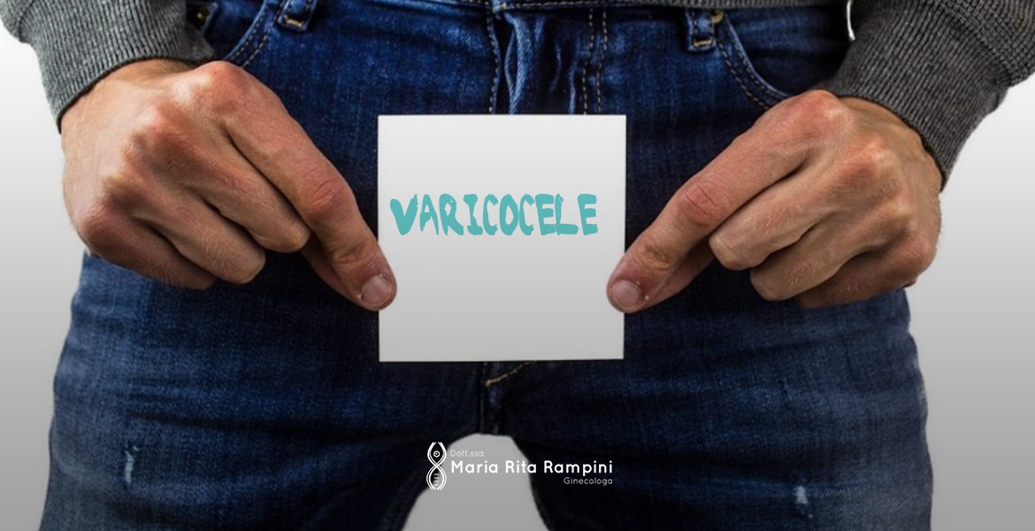 Varicocele