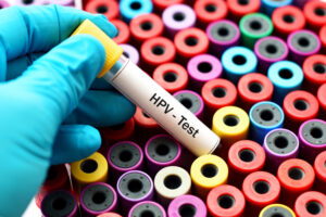 hpv_analisi_test