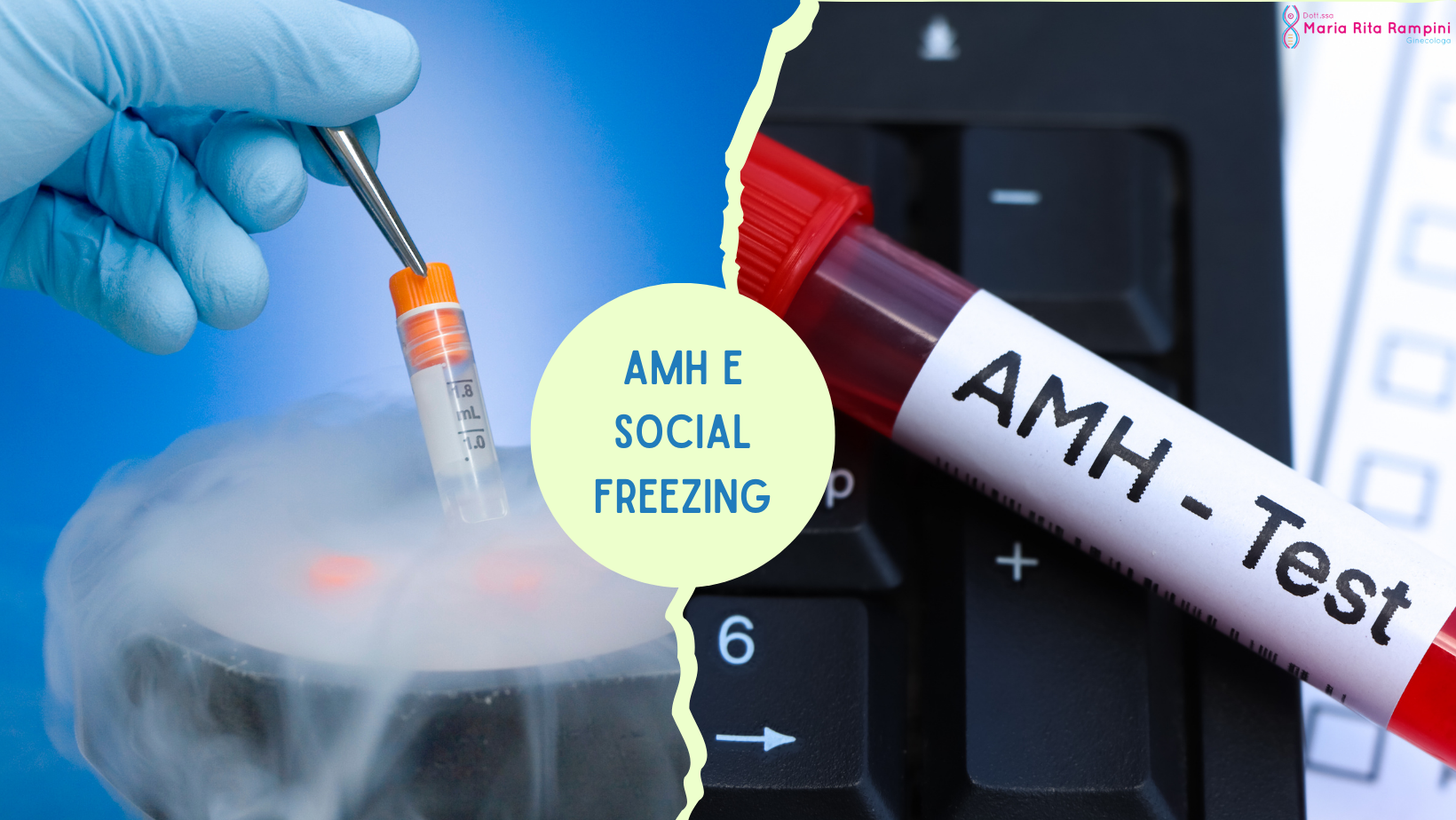 AMH e Social Freezing